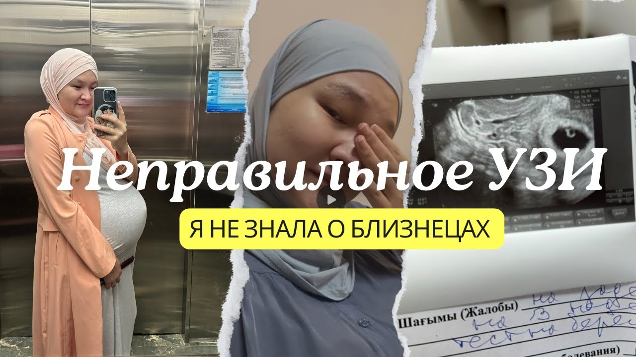 Как врач не увидел БЛИЗНЕЦОВ?! Врачи в Казахстане лучше. Сколько раз надо пройти УЗИ с двойней?