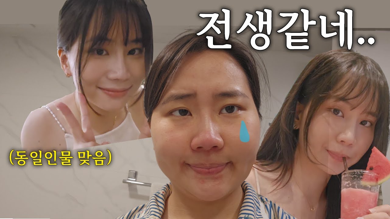 희귀병 브이로그 .4 스테로이드 부작용에 대한 전설을 아시나요