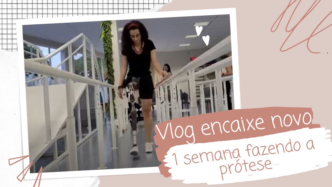 Encaixe novo da prótese de desarticulação de quadril | Taiana Lopes