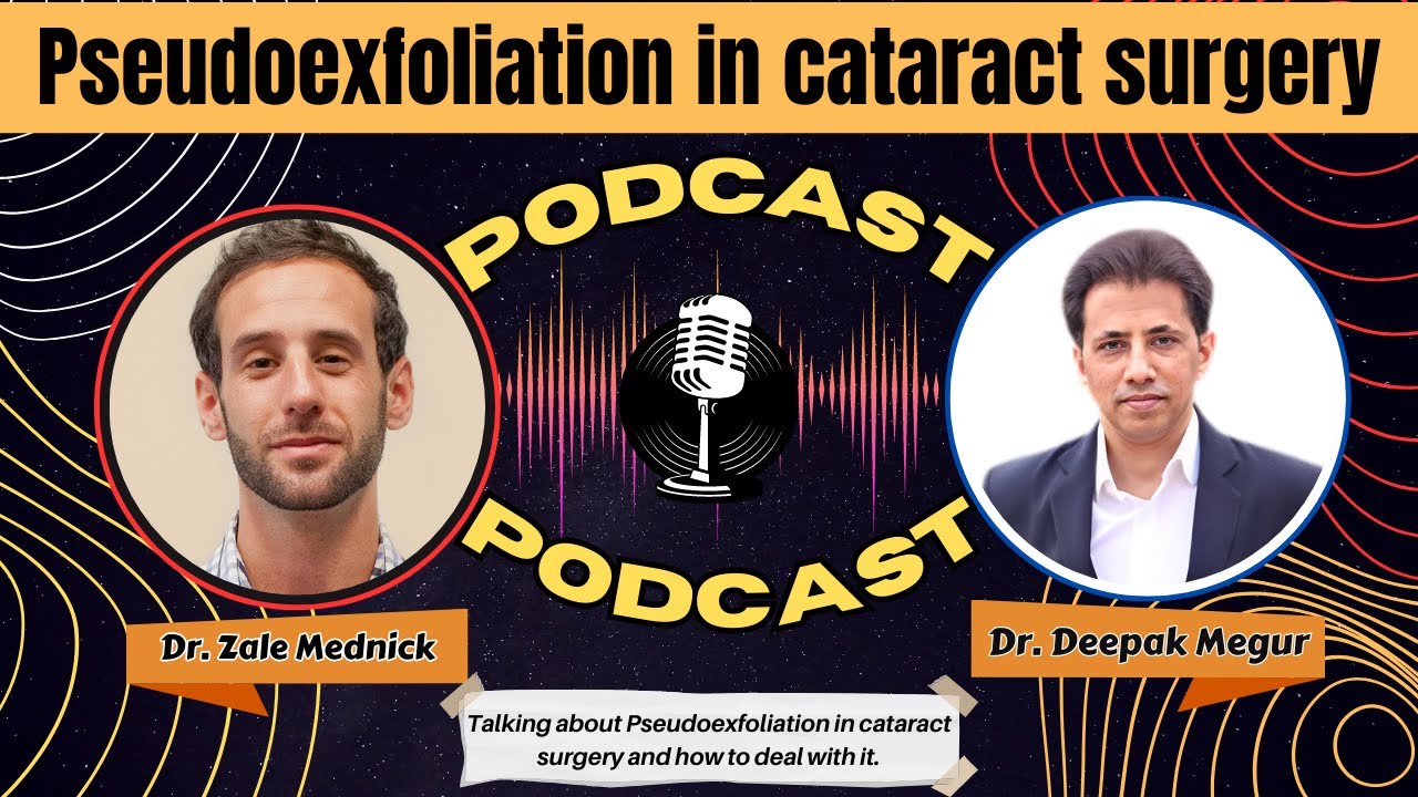 Pseudoexfoliation in cataract surgery. Podcast with @zalemednick8526 ​