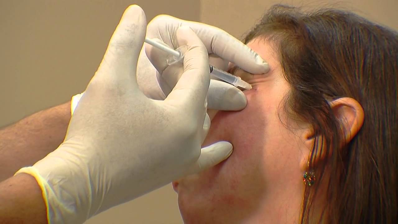 Botox Injections: Frown Lines & Crows Feet