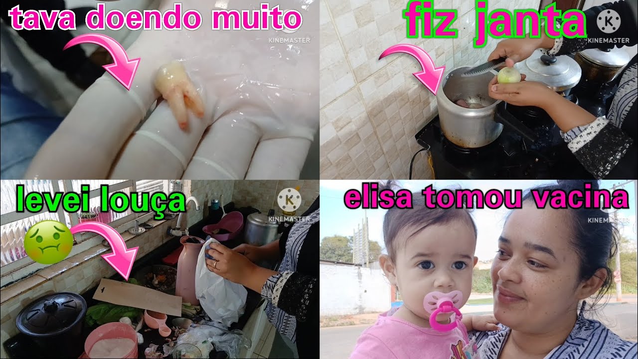 Dia difícil por aki elisa tomou vacina tive que tirar o,dente 