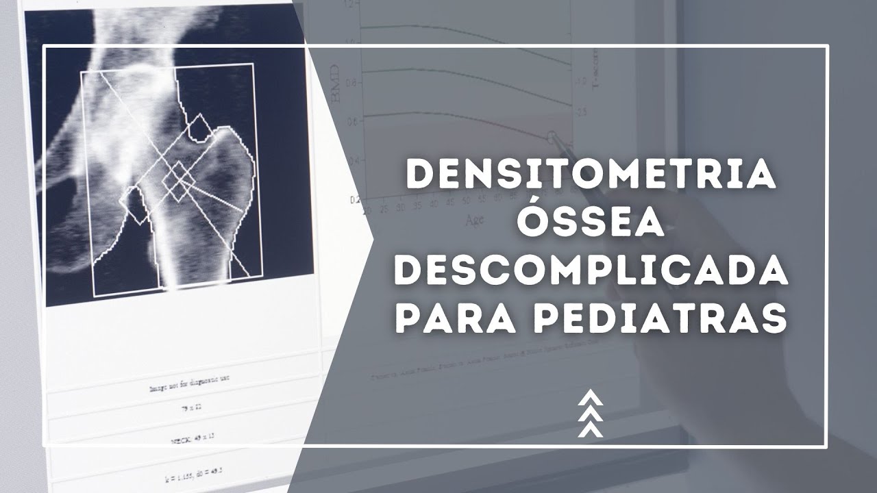 Densitometria óssea descomplicada para pediatras: um guia prático de avaliação da saúde óssea