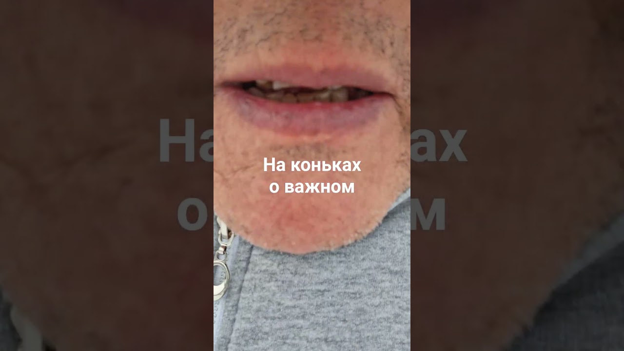 на катке о важном,о политике и тп