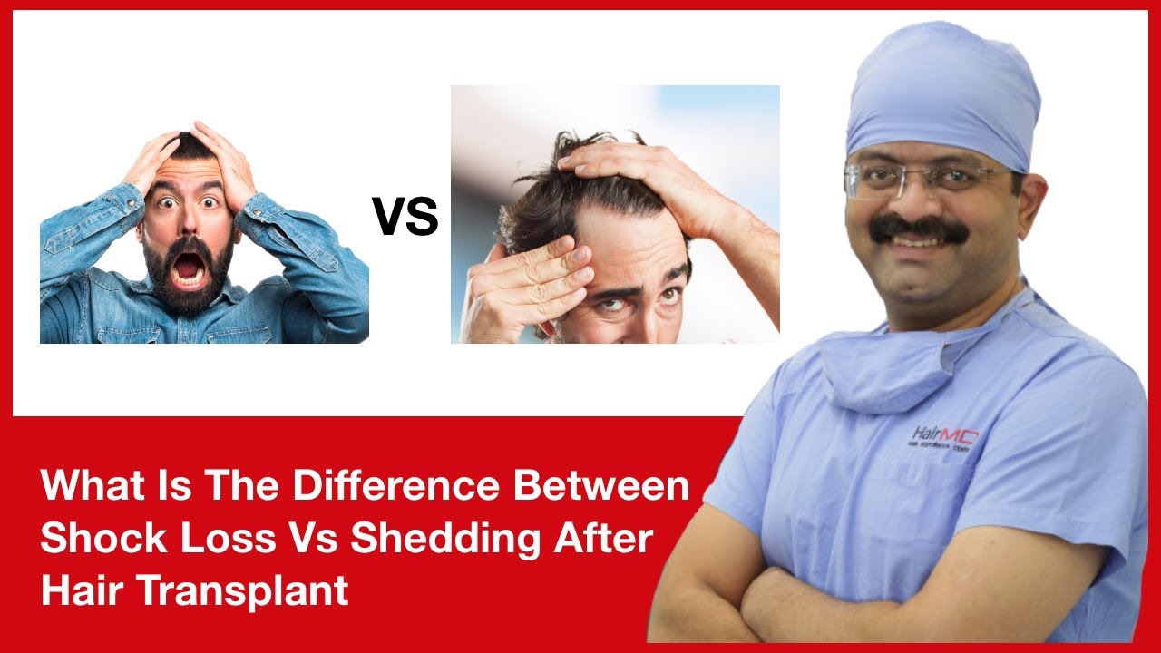 What Is The Difference Between Shock Loss Vs Shedding After Hair Transplant | (In HINDI)