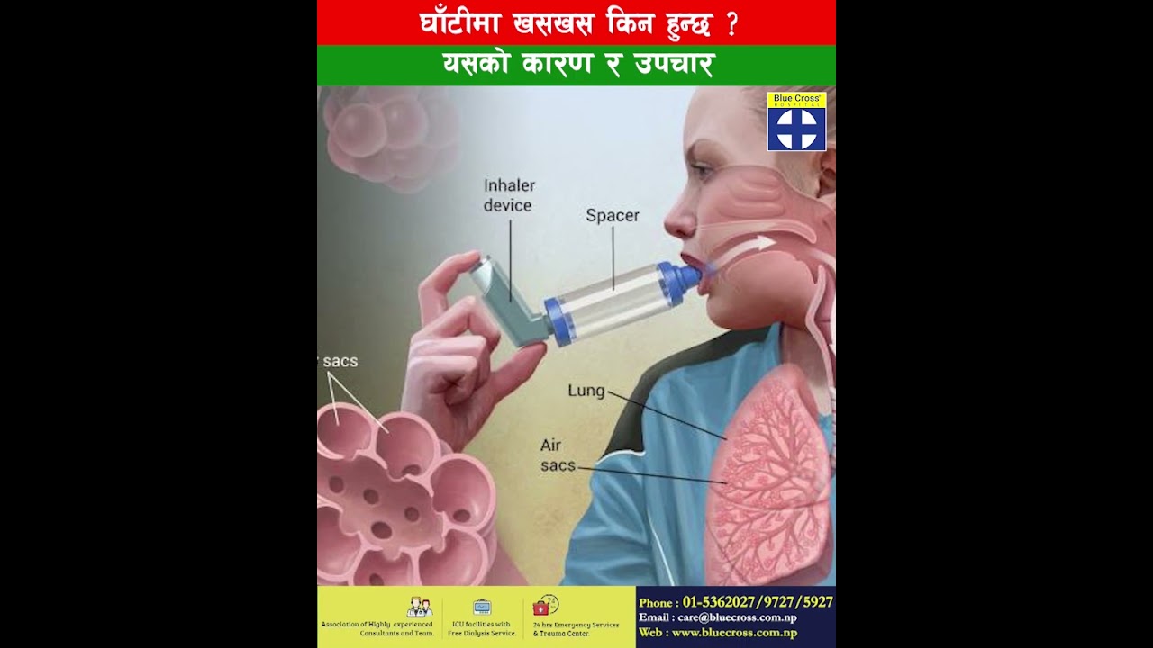 घाटी खसखस किन हुन्छ? डा. सृति मानन्धर. #entandheadandnecksurgeon #bluecosshospital