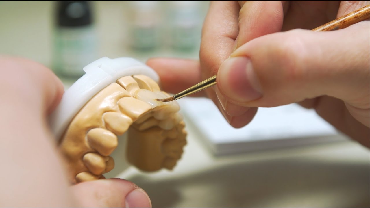 3D Druck im Dentallabor: Digitale Fertigung von provisorischen Kronen & Br&uuml;cken mit Freeprint&reg; temp