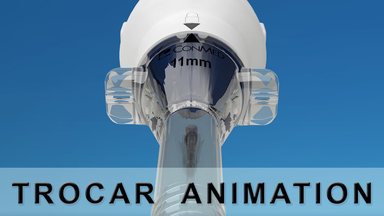 Trocar Medical Animation