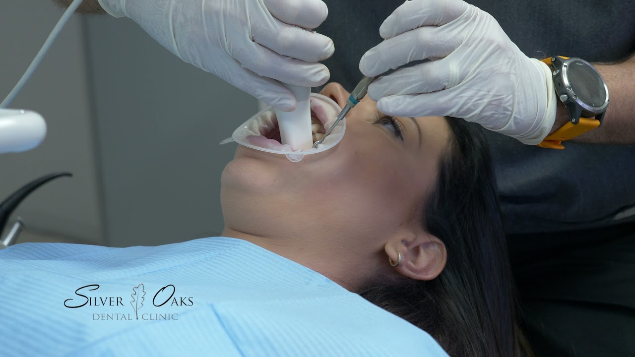 Digital Smile Design - PREPARATION OF YOUR NEW SMILE & TEMPORISATION