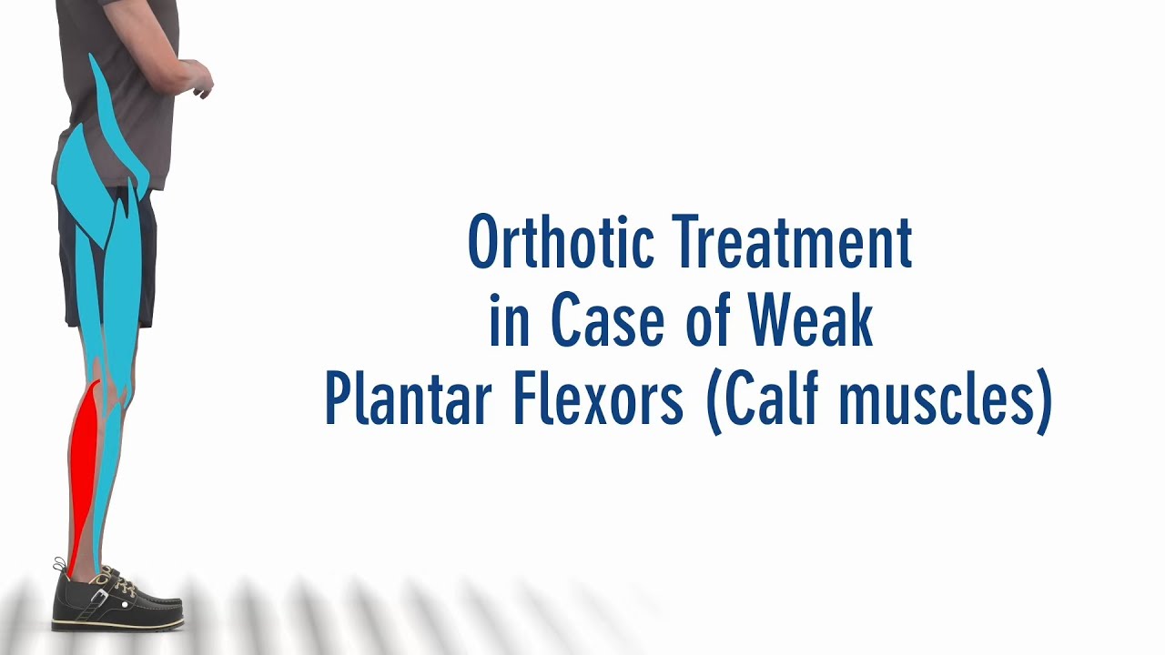 EN: FIOR & GENTZ - The Right Orthosis in Case of Paralysed Plantar Flexors