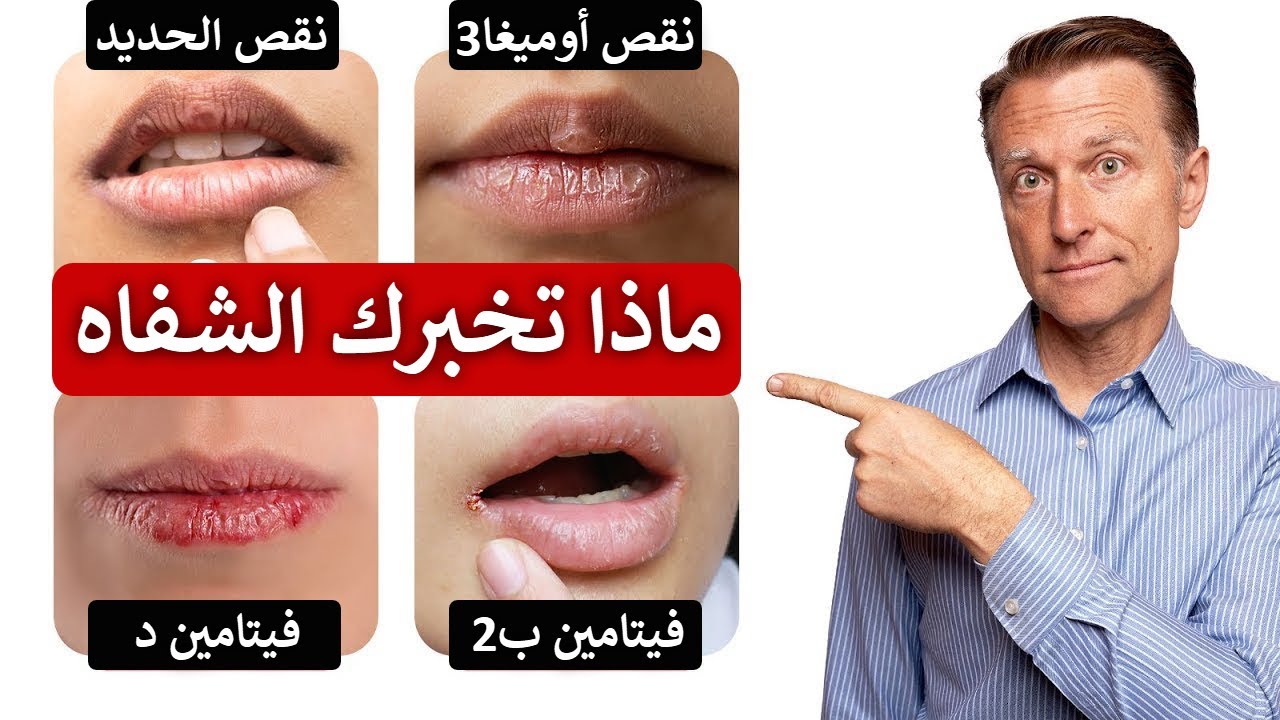 5 أشياء تخبرك بها شفتيك عن أمراض الجسم ونقص الفيتامينات والمعادن