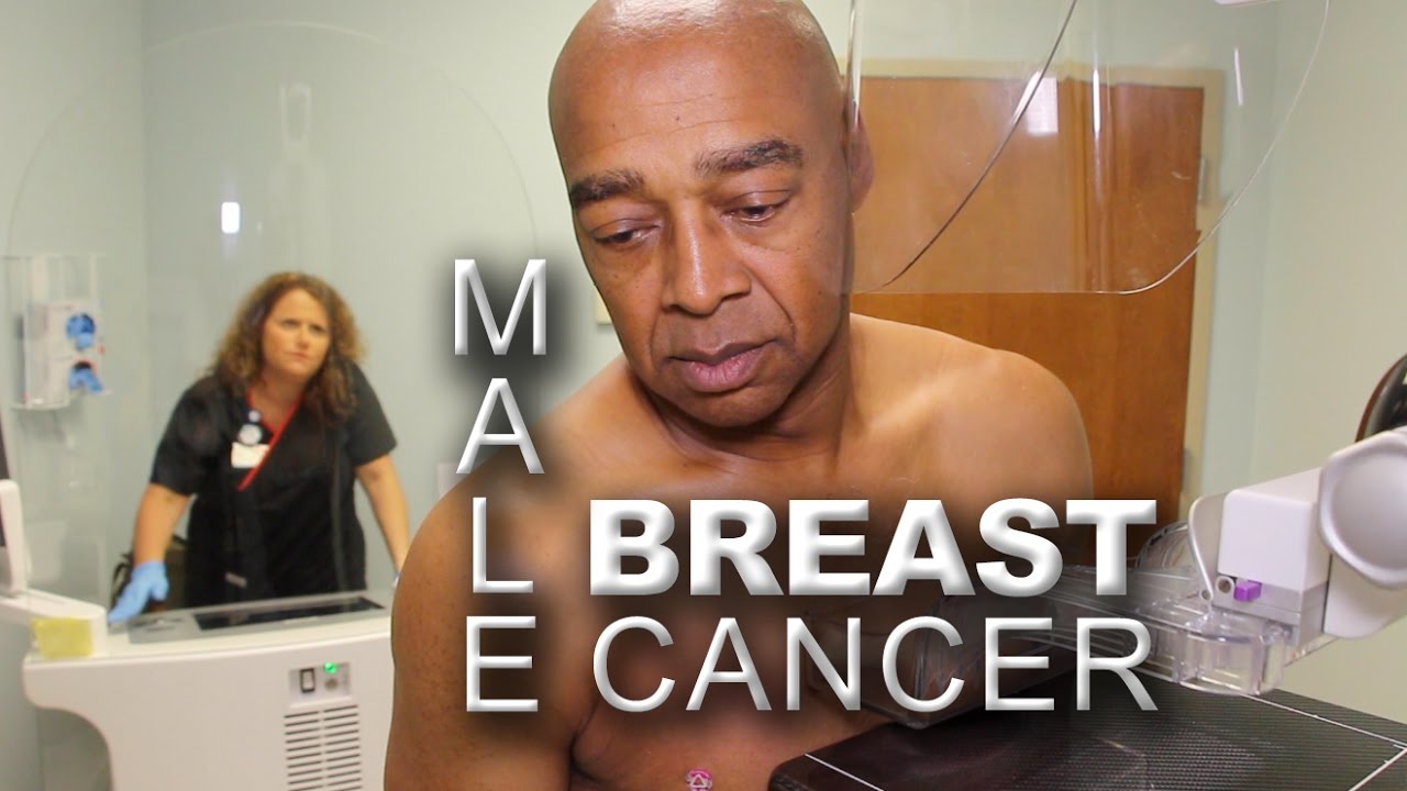 Men and Mammography | Early Detection of Male Breast Cancer