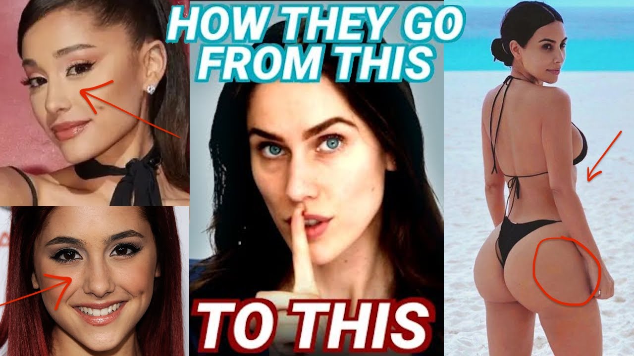“I’ve Never Had Work Done.” How Celebrities Get Away With Lying To Us About Treatments/Procedures