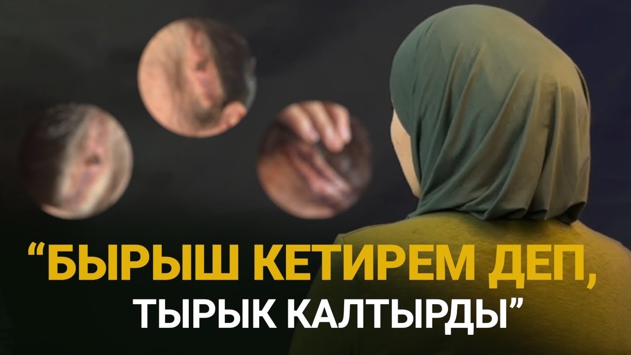 Пластикалык операциянын жабырлануучусу прокуратурага кайрылды