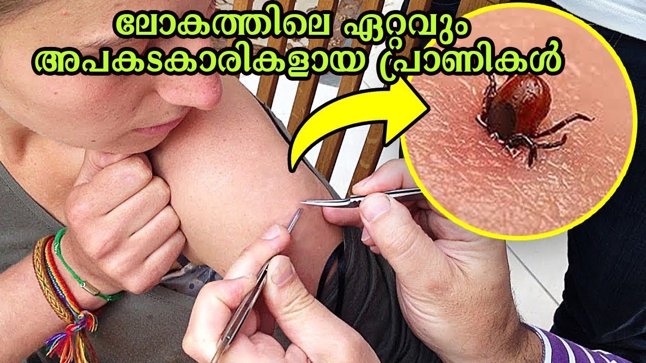 ഈ പ്രാണികളെ കണ്ടാൽ ഓടിക്കോ അപ്പോൾ തന്നേ