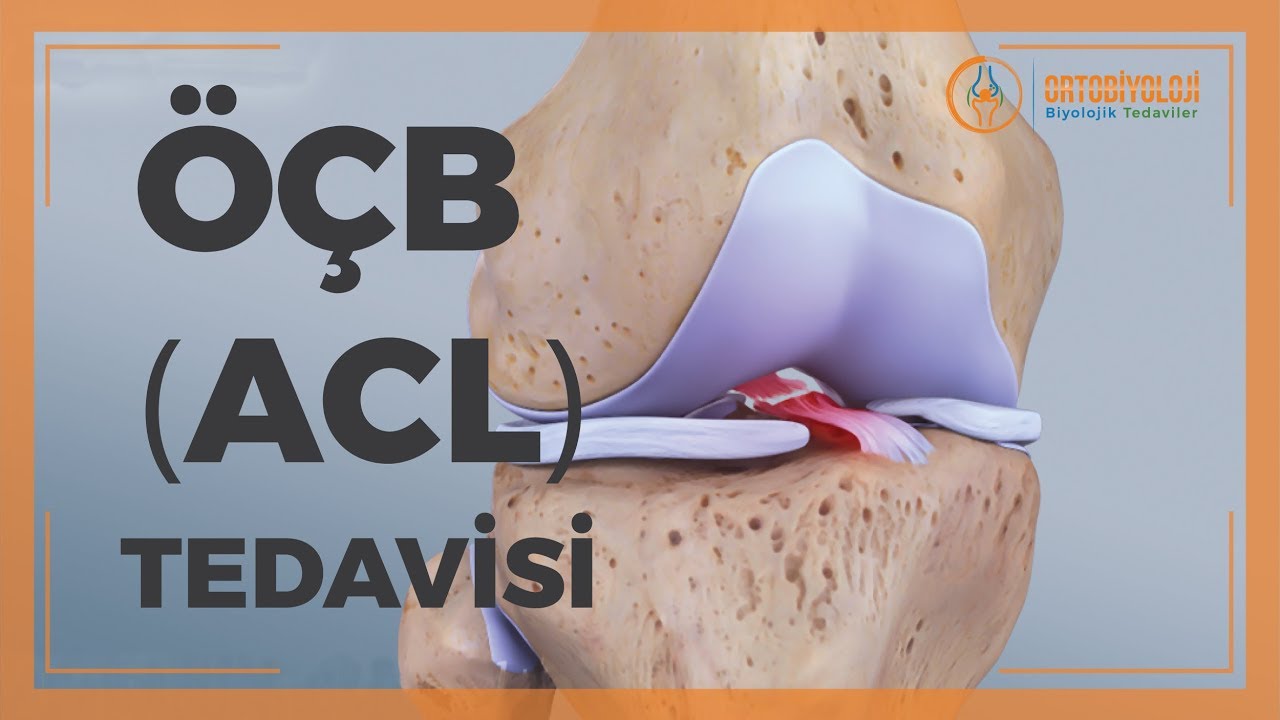 ÖN ÇAPRAZ BAĞ (ACL) KOPUĞU VE SEÇKİN ÖÇB TEDAVİLERİ