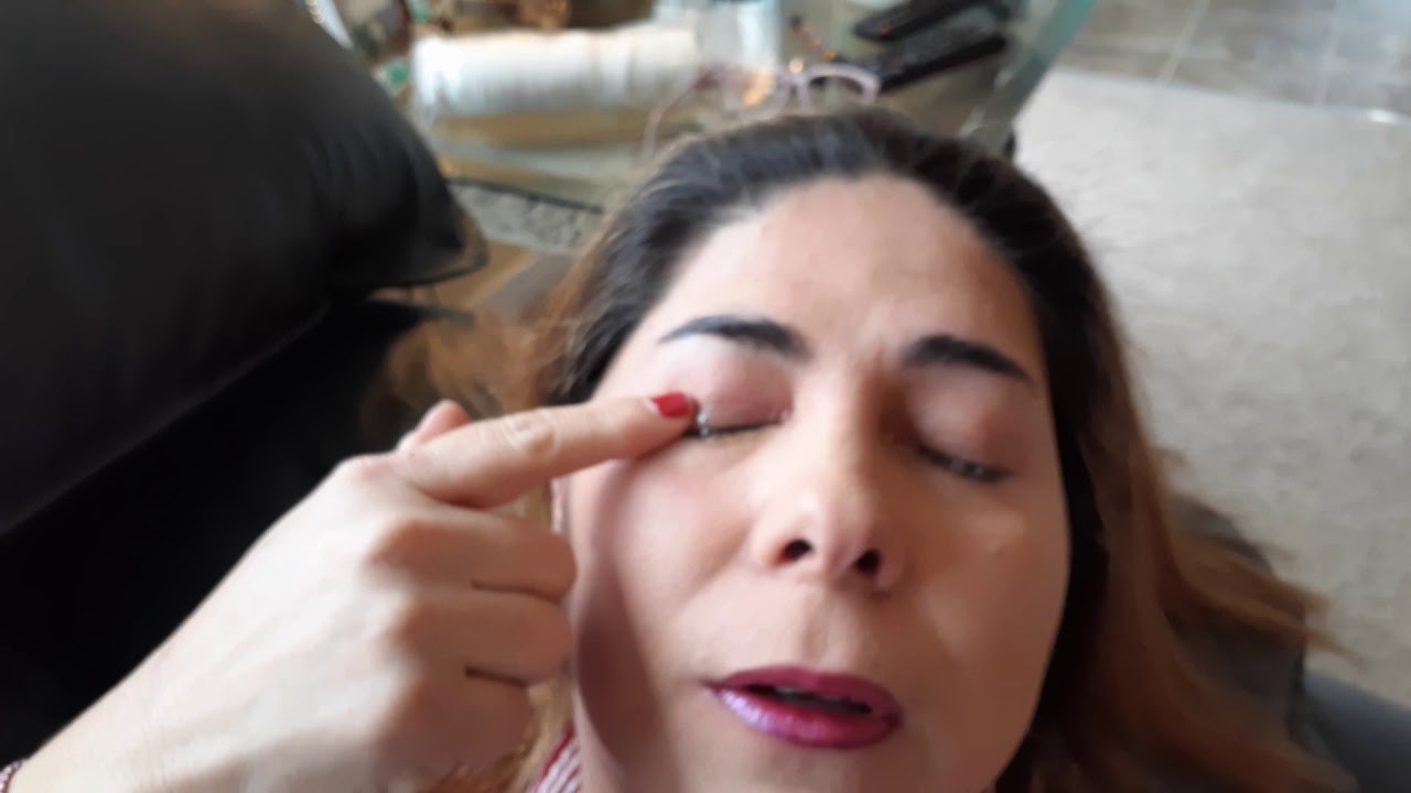 Miel de senorita , miel de Chumelo,melipona para reducir cataratas y carnocidad en los ojos.❤🤍💙