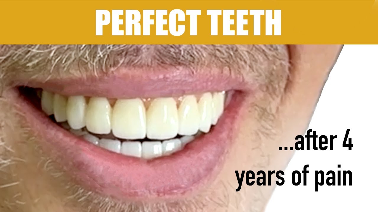 Perfect Teeth: After 4 Years of Pain