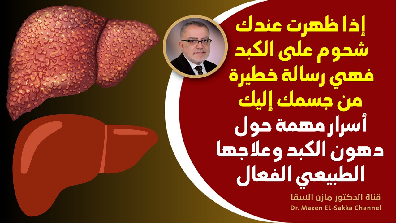 شحوم على الكبد إنها رسالة هامة من جسمك | دهون الكبد وعلاجها الفعال | أسهل طريقة لإزالة دهون الكبد