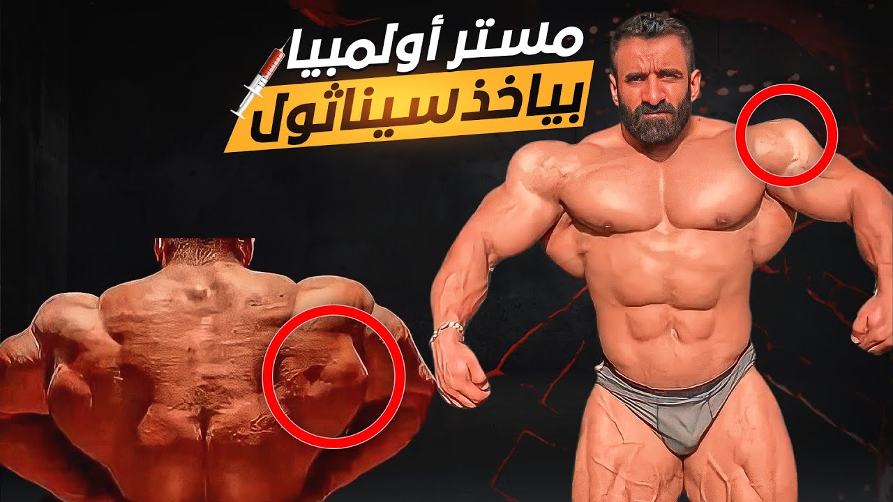 هادي شوبان حيخسر المستر أوليمبيا