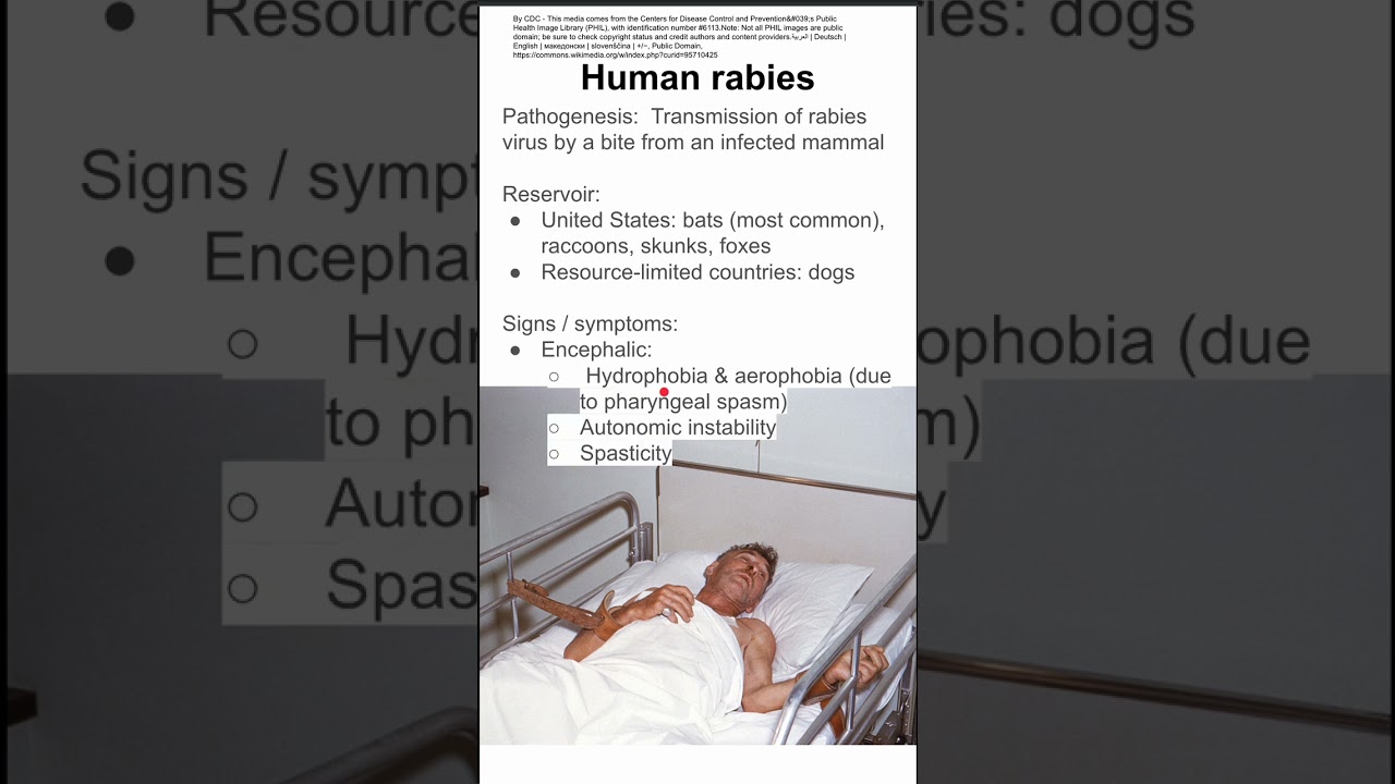 Человеческое бешенство