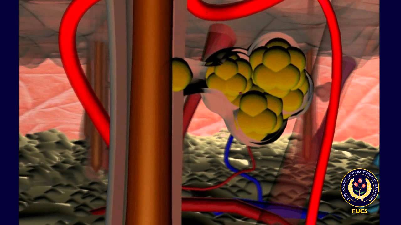Fisiopatología del acné