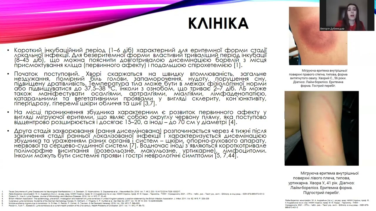 Нейробореліоз: від клініки до діагностики (2026)