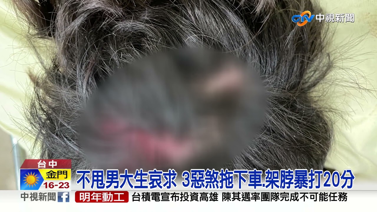 男大生擦撞瑪莎拉蒂遭暴打 ! 落跑3煞全抓到│中視新聞 20211110
