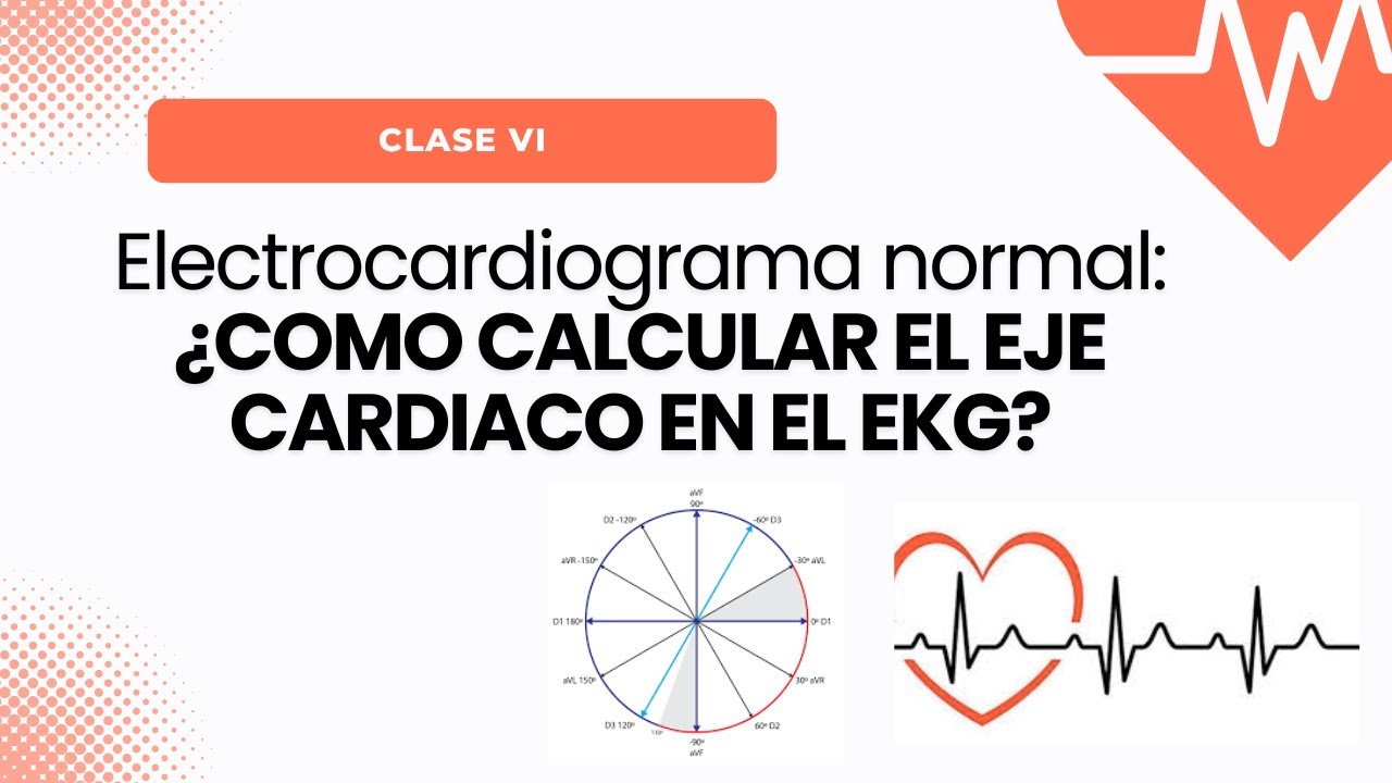 Electrocardiograma normal: EJE CARDIACO, EJEMPLOS Y FORMAS DE CALCULARLO