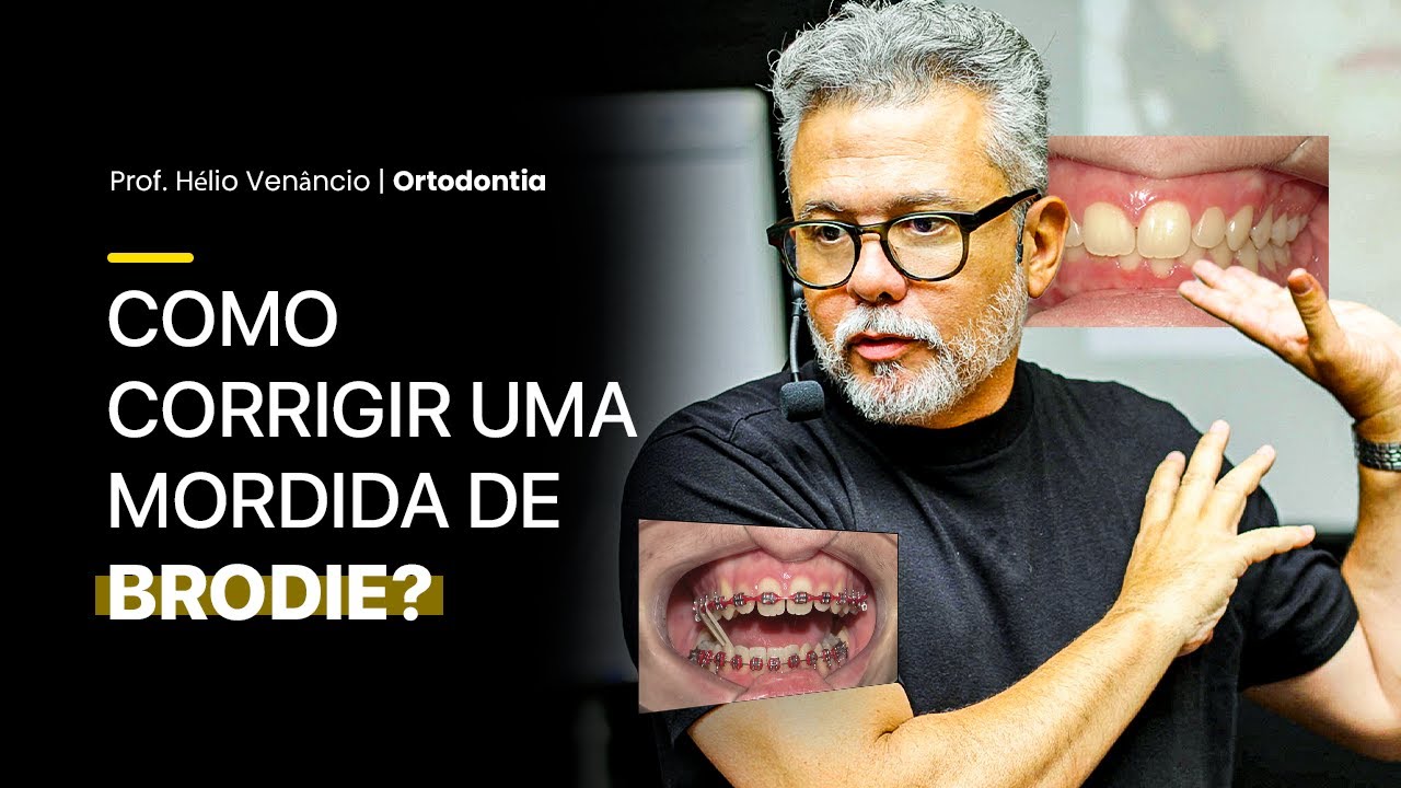COMO CORRIGIR UMA MORDIDA DE BRODIE? 😝