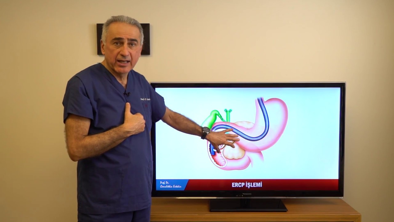 ERCP işlemi nedir, nasıl yapılır, yan etkileri nelerdir?