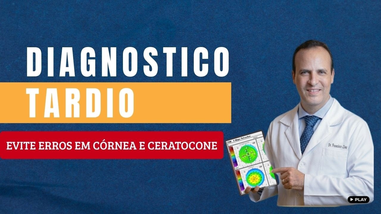 Diagnóstico Tardio: Evite Erros em Córnea e Ceratocone