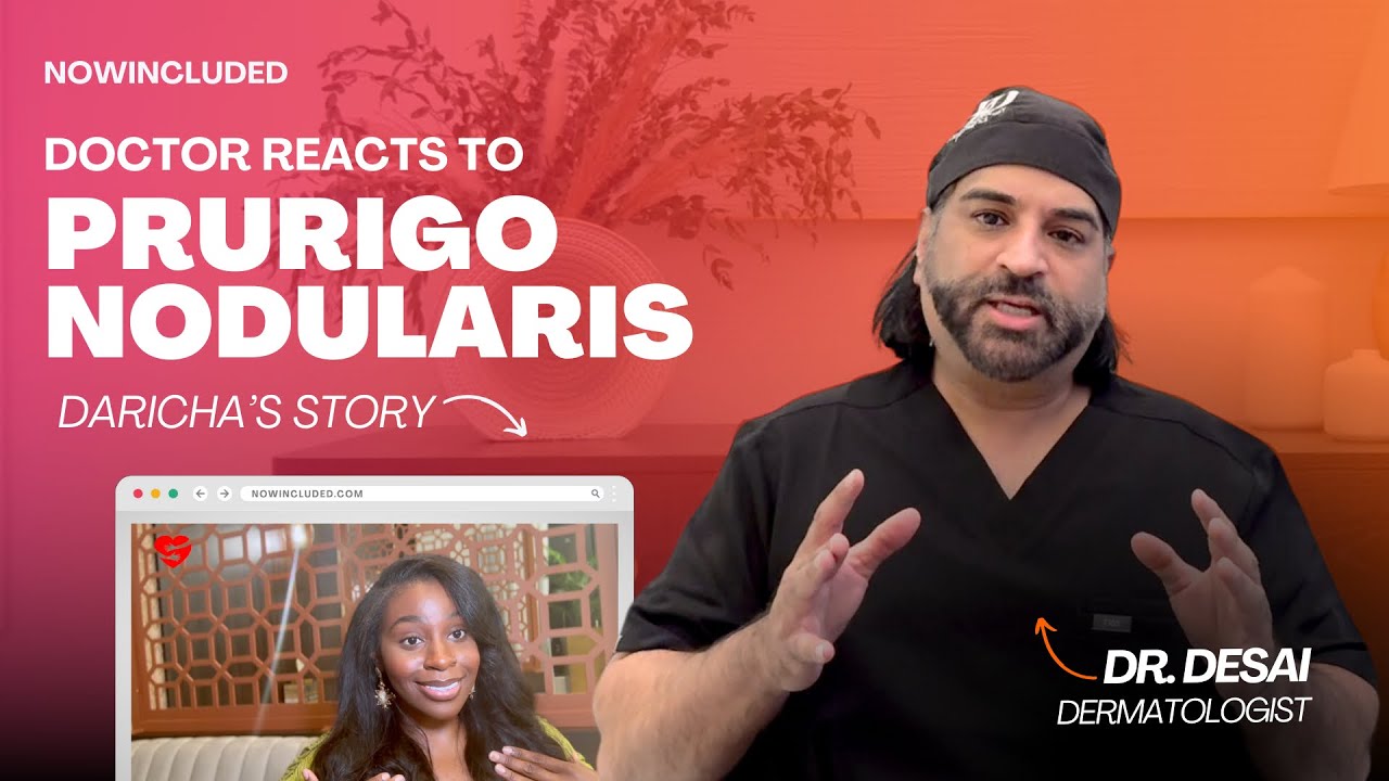 Doctor Reacts to Daricha's Prurigo Nodularis Journey