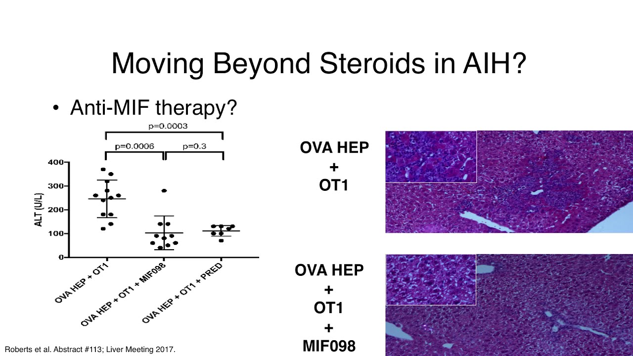 Autoimmune Hepatitis Research Update