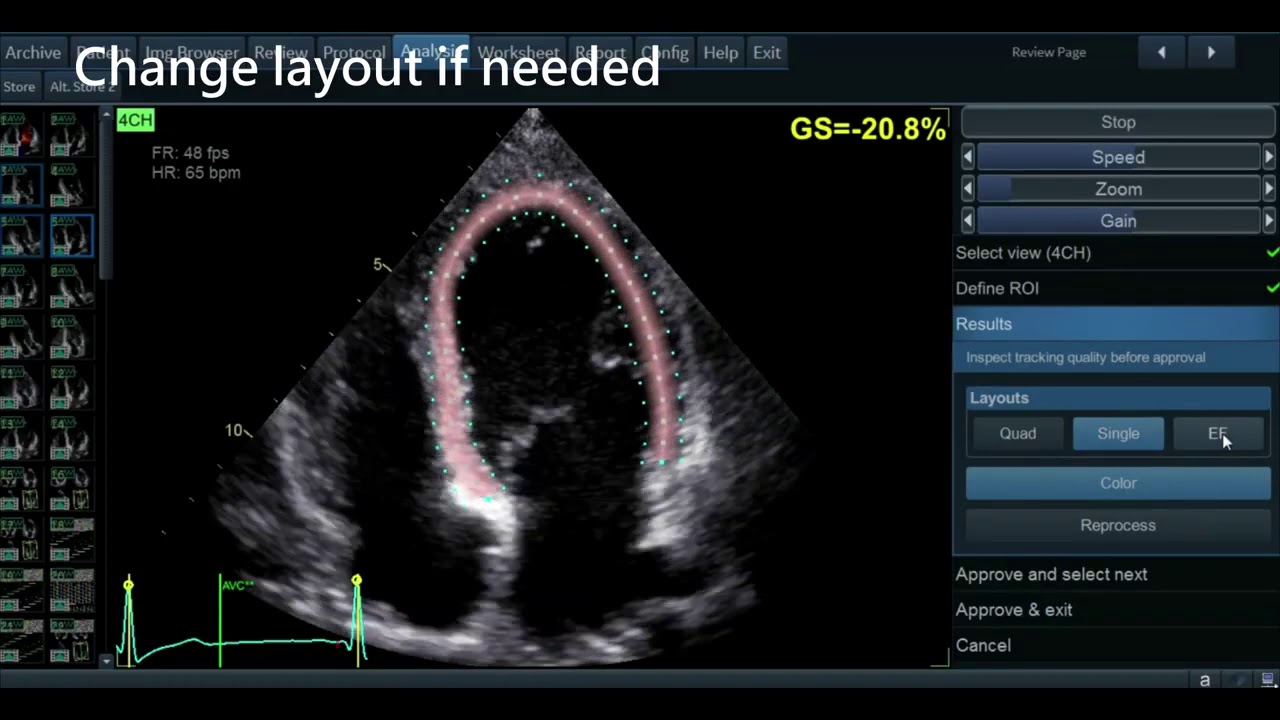 GE Vivid AFI 2 0 Demo