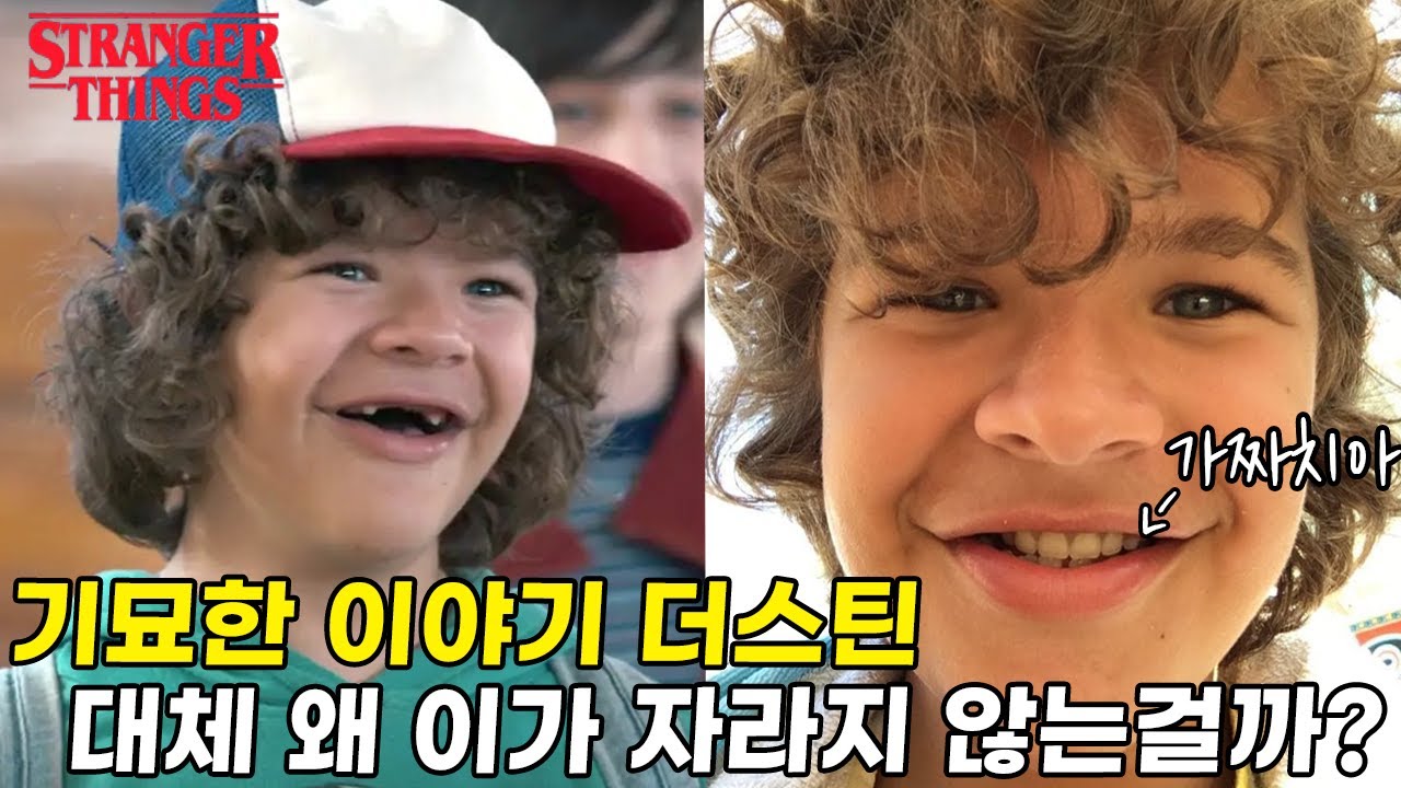 기묘한이야기 더스틴, 치아와 쇄골이 없는 게 연출이 아니었다?