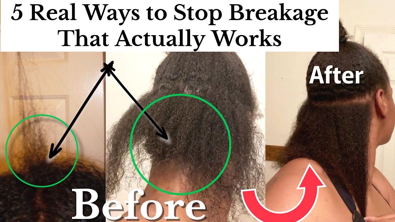 HAIR BREAKAGE SOLUTIONS THAT ACTUALLY WORKS: OVERCOME BREAKAGE #naturalhair #4chair #haircare #hair