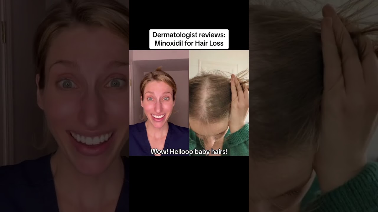 Hey ladies, this treatment for #hairloss WORKS.