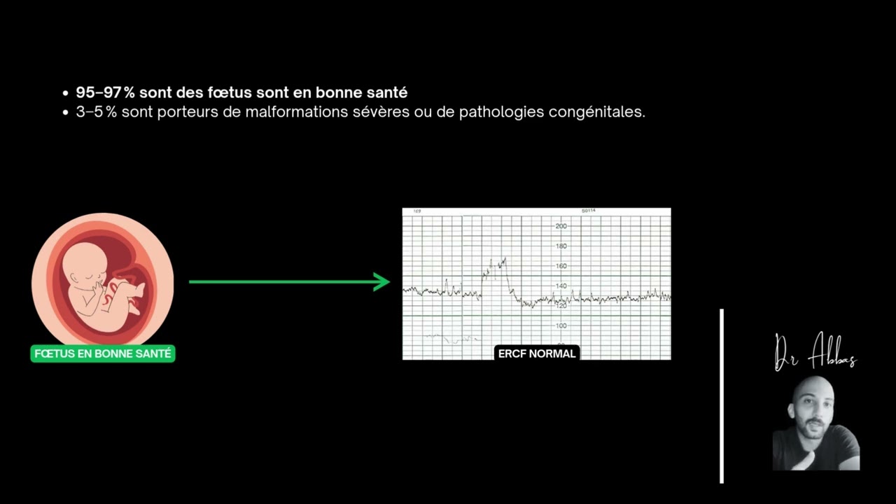 Comment interpréter un ercf : Épisode 09 - Mécanisme de la souffrance fœtale