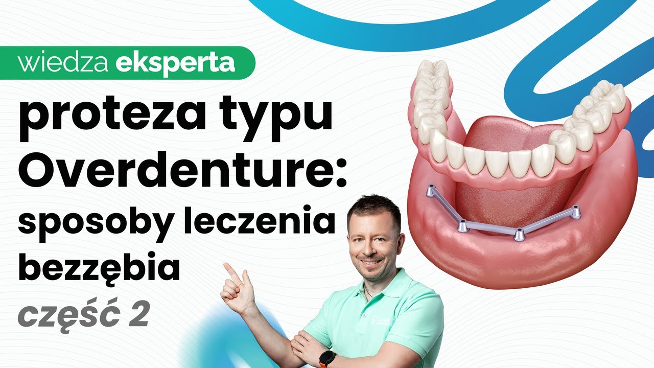 SPOSOBY REKONSTRUKCJI BEZZĘBIA. PROTEZA CZY MOST NA IMPLANTACH? CO WYBRAĆ?