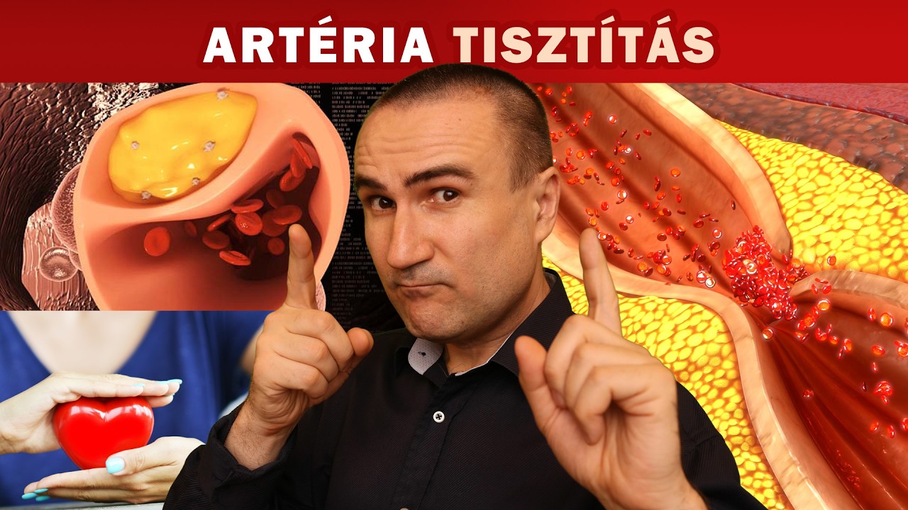 3+1 csúcs-étel az Artériák megtisztításához