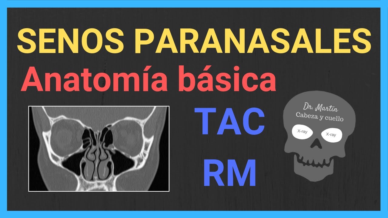 SENOS PARANASALES: ANATOMÍA radiológica👃