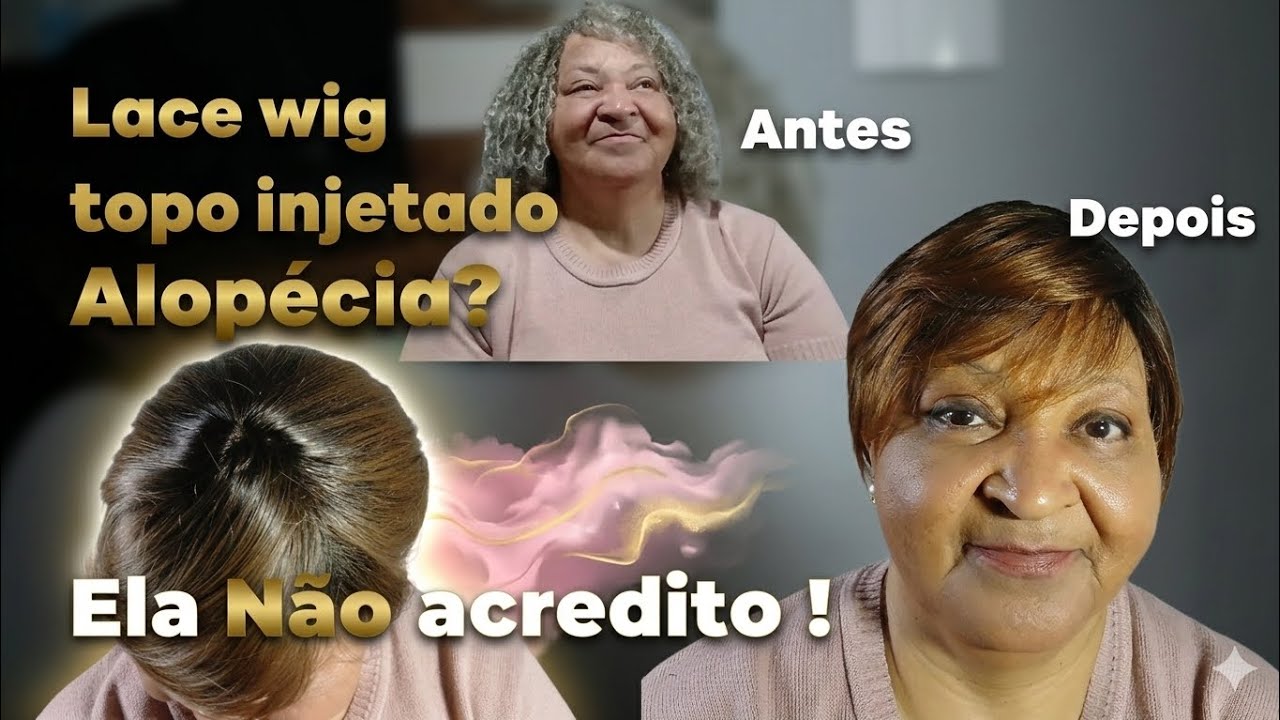 TRANSFORMAÇÃO SURPRESA: LACE WIG COM TOPO INJETADO 