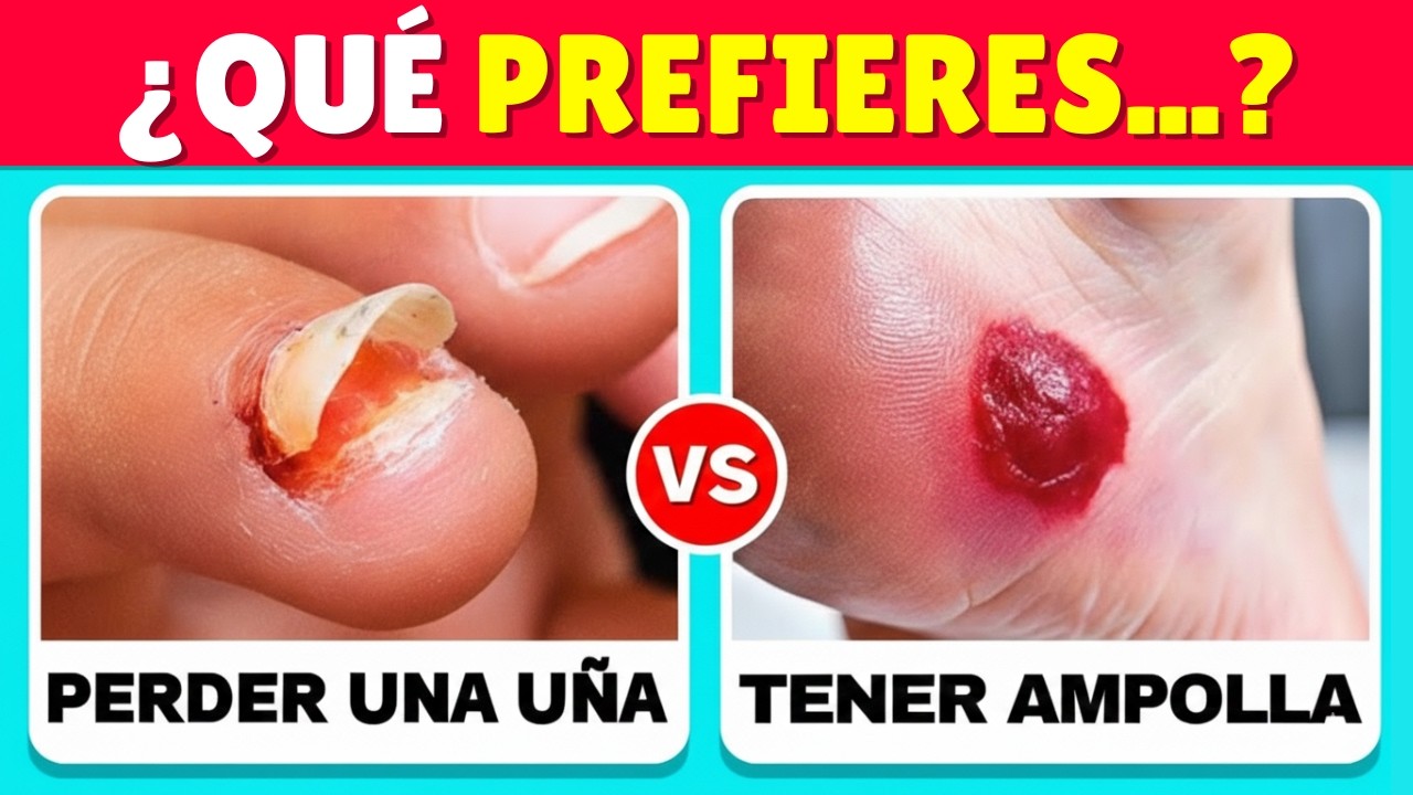 ¿Qué PREFIERES? 😰 ¡Las Decisiones MÁS DIFÍCILES de tu Vida! ⚠️🔥