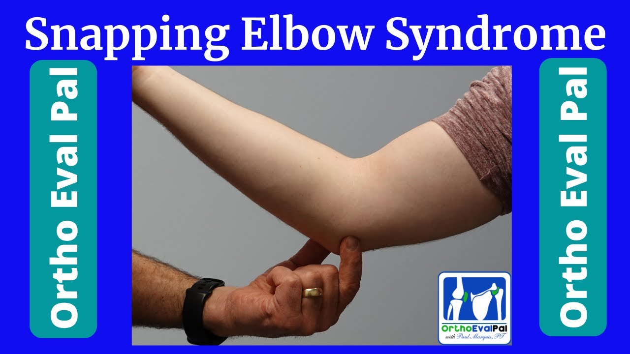 Snapping Elbow Syndrome