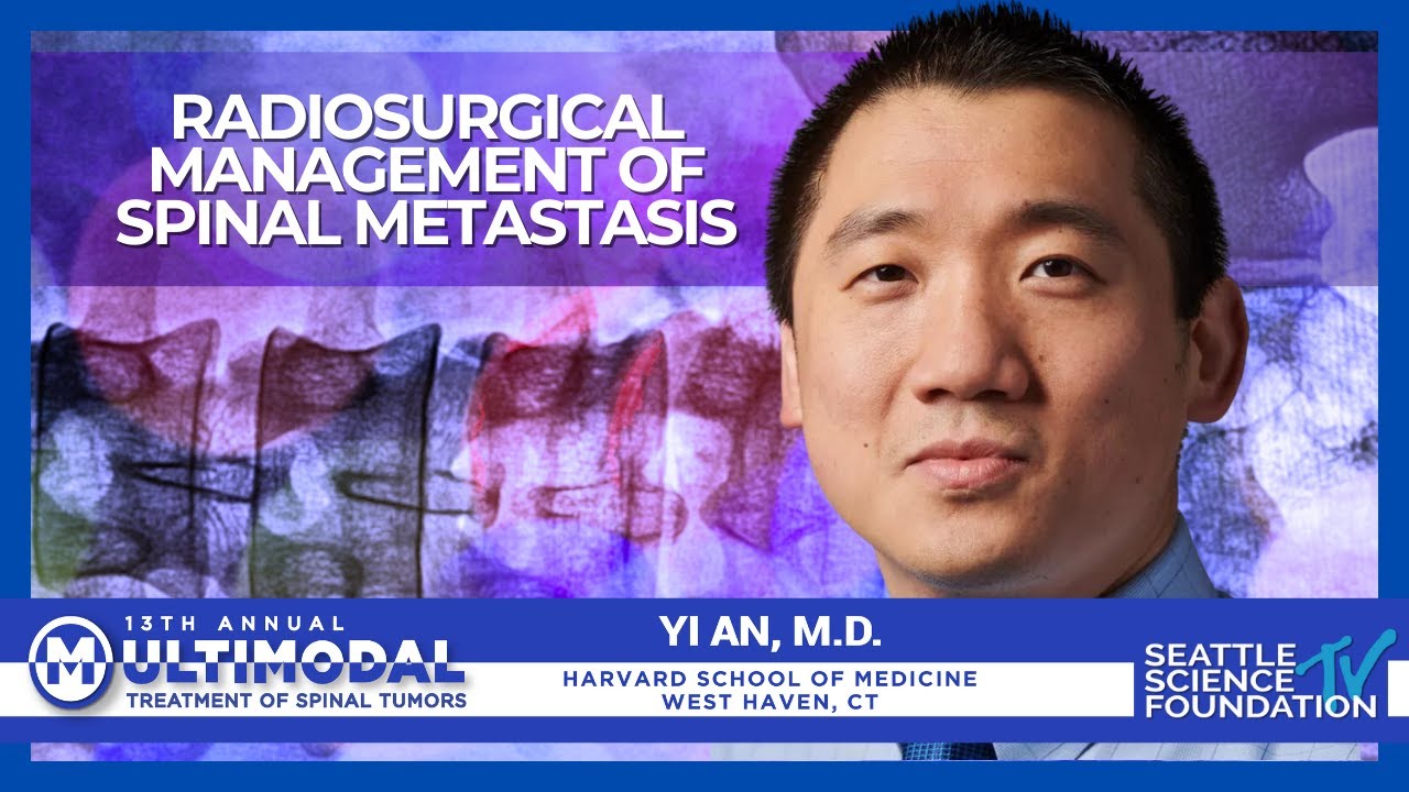 Radiosurgical Management of Spinal Metastasis - Yi An, M.D.