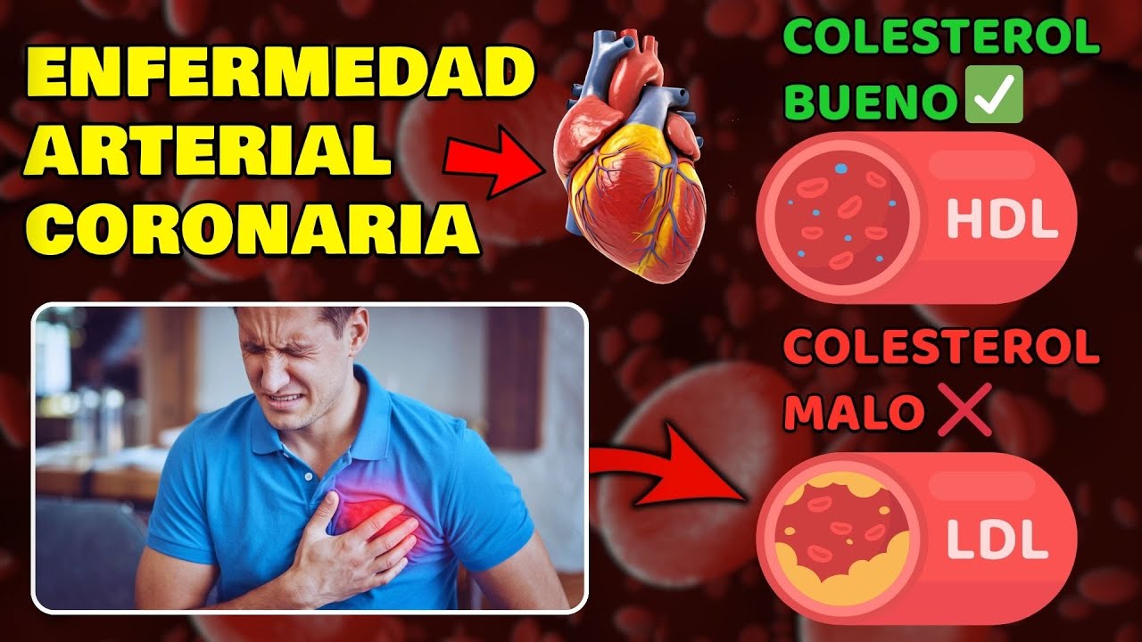 ENFERMEDAD ARTERIAL CORONARIA | CAUSAS y PREVENCIÓN🫀🩺
