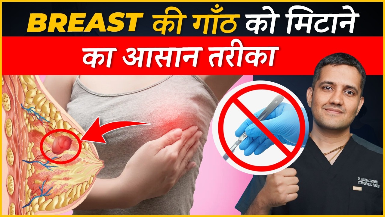 Q&A Related to breast fibroadenomas | Is it breast cancer? | Dr. Gaurav Gangwani (IR)
