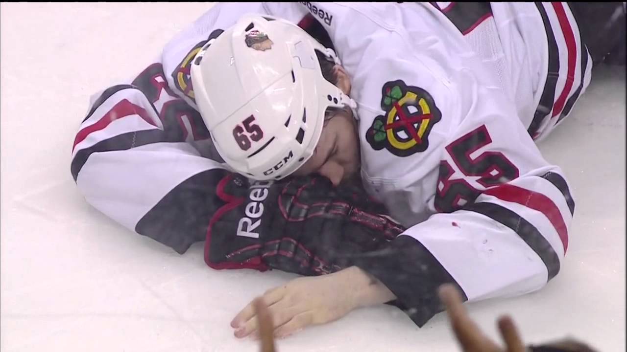 Stanley Cup Final: Andrew Shaw takes puck to the face in Game 6