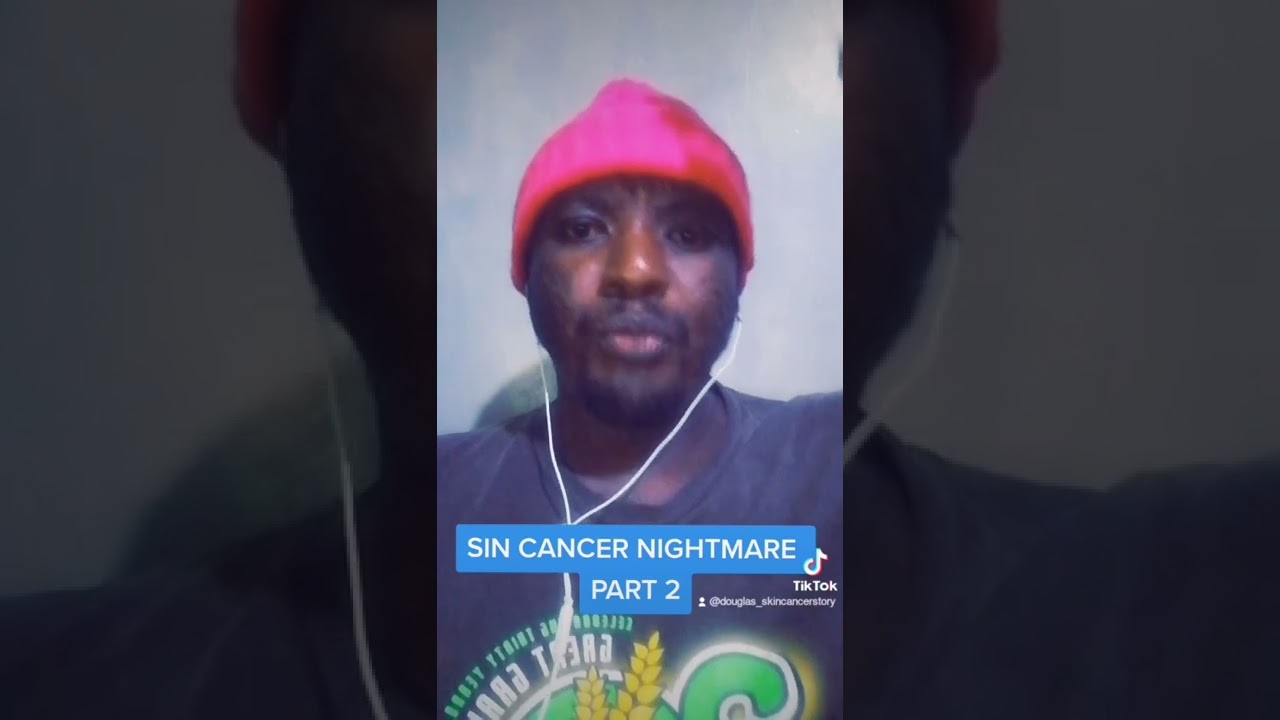 SKIN CANCER NIGHTMARE